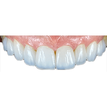 Prostodontics <br/> Dentistry